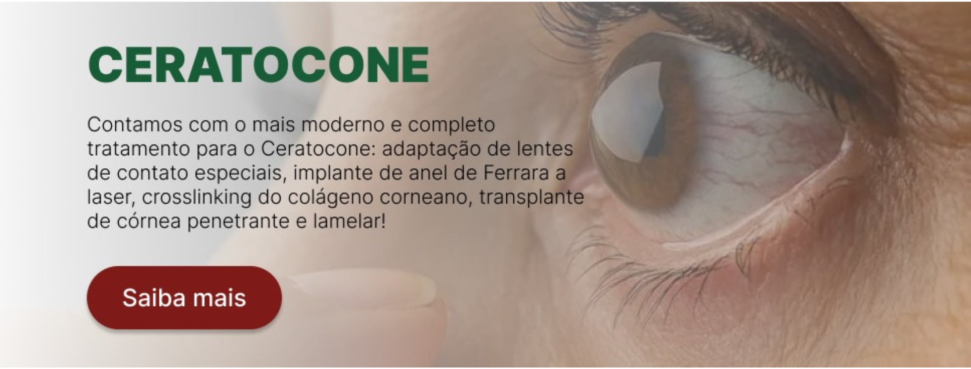 ceratocone